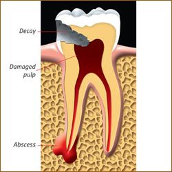 Tooth Care